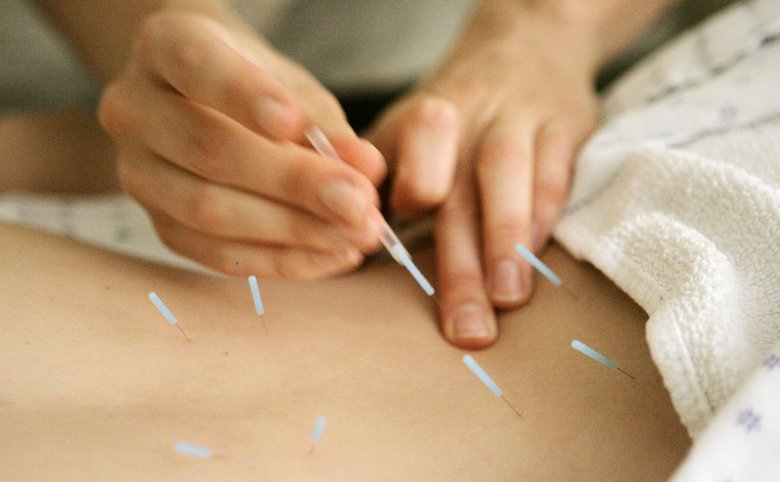 Acupuncture For Back Pain – By Acupuncture NYC Licensed Dr. Frank FengYu Zhao