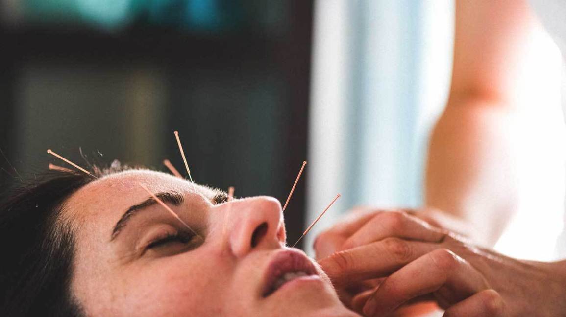 Facial Acupuncture Points Cosmetic