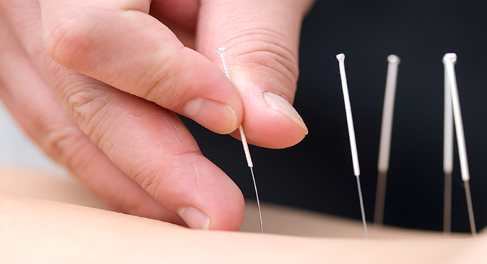 ACUPUNCTURE AND Traditional Chinese Medicine CLINIC