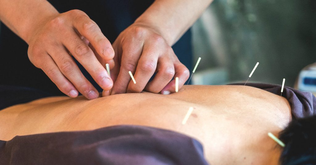 What are the main licensed Acupuncturist practices?