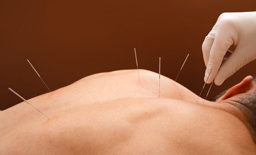 Complete Acupuncturist FengYu Zhao Profile