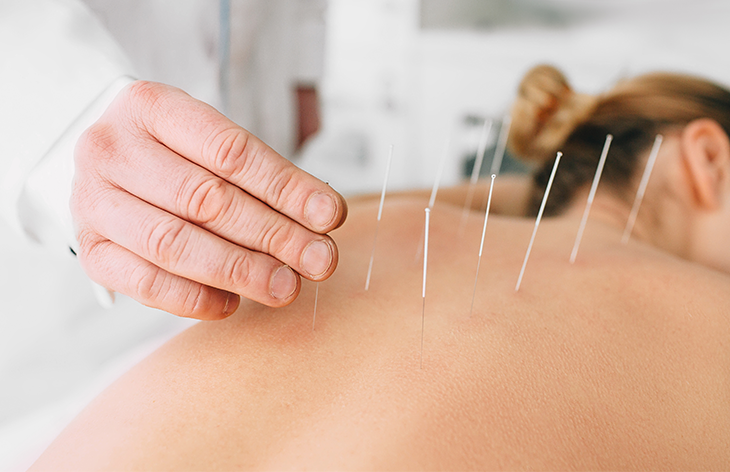 An Overview of Acupuncture and TCM