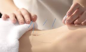 Enhancing Fertility Acupuncture Role in Reproductive Health