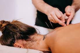 Integrating Acupuncture into Your Self-Care Routine