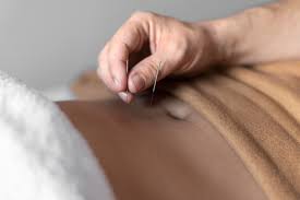 Finding Balance Treating Digestive Issues with Acupuncture