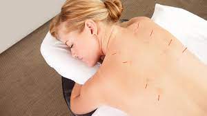 Unlocking Your Body’s Potential Acupuncture and Healing