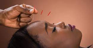 Resilience and Renewal Overcoming Trauma with Acupuncture