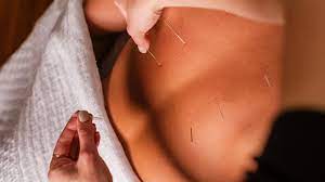 Revitalize Your Health How Acupuncture Works for Everyone