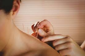 Balancing Energy Flow The Key Principles of Acupuncture